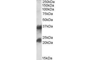 Image no. 1 for anti-Clathrin, Light Chain A (CLTA) (Internal Region), (Light Chain) antibody (ABIN375031) (CLTA antibody  (Internal Region, Light Chain))