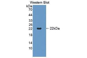 Western blot analysis of the recombinant protein. (CD40 antibody  (AA 26-193))