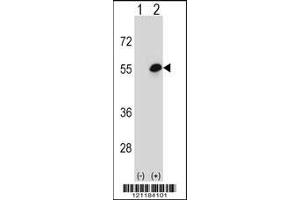 Western blot analysis of COCH using rabbit polyclonal COCH Antibody using 293 cell lysates (2 ug/lane) either nontransfected (Lane 1) or transiently transfected (Lane 2) with the COCH gene. (COCH antibody  (AA 399-428))