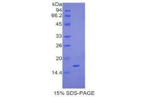SDS-PAGE (SDS) image for Complexin 2 (CPLX2) (AA 1-134) protein (His tag) (ABIN1821747)