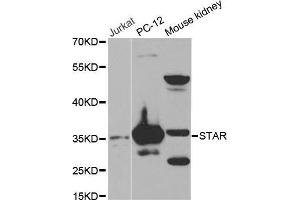 Western blot analysis of extracts of various cell lines, using STAR antibody. (STAR antibody  (AA 64-285))