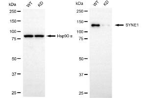 anti-Spectrin Repeat Containing, Nuclear Envelope 1 (SYNE1) antibody