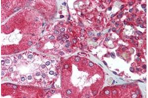 Human Kidney (formalin-fixed, paraffin-embedded) stained with XBP1 antibody ABIN214020 at 5 ug/ml followed by biotinylated goat anti-rabbit IgG secondary antibody ABIN481713, alkaline phosphatase-streptavidin and chromogen. (XBP1 antibody  (C-Term))