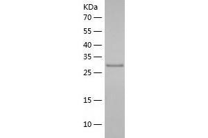 Western Blotting (WB) image for DNA-Damage Inducible 1 Homolog 1 (DDI1) (AA 33-326) protein (His tag) (ABIN7288063) (DDI1 Protein (AA 33-326) (His tag))