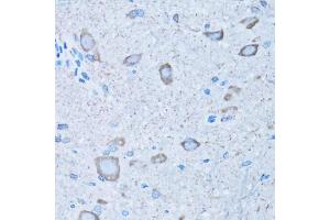 Immunohistochemistry of paraffin-embedded mouse spinal cord using NNMT antibody (ABIN5974021) at dilution of 1/100 (40x lens). (NNMT antibody)