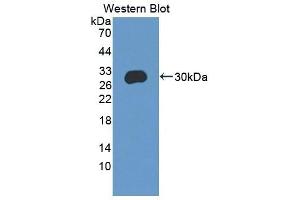 Detection of Recombinant CEBPd, Mouse using Polyclonal Antibody to CCAAT/Enhancer Binding Protein Delta (CEBPd)