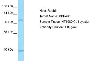 Host: RabbitTarget Name: PPP4R1Antibody Dilution: 1. (PPP4R1 antibody  (Middle Region))
