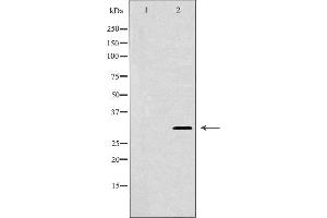Western blot analysis of 293T whole cell lysates, using HUS1 Antibody. (HUS1 antibody  (Internal Region))