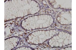 Immunoperoxidase of monoclonal antibody to CDK5RAP3 on formalin-fixed paraffin-embedded human colon. (CDK5RAP3 antibody  (AA 1-506))
