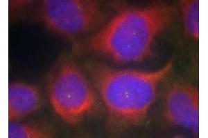 Image no. 1 for anti-NMDA Receptor 1 (NMDA R1) (AA 895-899) antibody (ABIN401632) (NMDA 1 Receptor antibody  (AA 895-899))