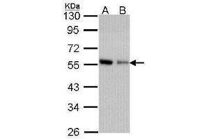 WB Image Sample (30 ug of whole cell lysate) A: A431 , B: H1299 10% SDS PAGE antibody diluted at 1:1000 (CORO1C antibody  (C-Term))