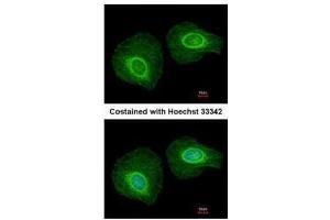 ICC/IF Image Immunofluorescence analysis of methanol-fixed HeLa, using Cytokeratin 34, antibody at 1:200 dilution. (Keratin 34 antibody)