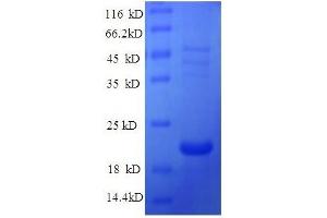 Protein expressed in E. (Ephrin A1 Protein (EFNA1) (AA 18-182, full length) (His tag))