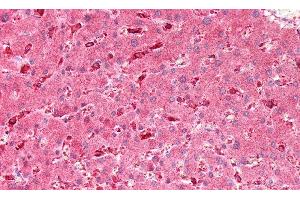 Detection of GBA in Human Liver Tissue using Polyclonal Antibody to Glucocerebrosidase (GBA) (GBA antibody  (AA 334-498))