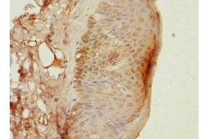 Immunohistochemistry of paraffin-embedded human skin tissue using ABIN7149639 at dilution of 1:100 (DAZ2 antibody  (AA 1-200))