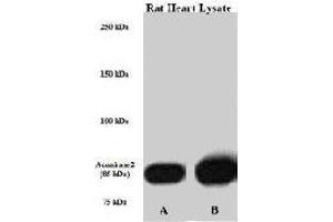 Perfused isolated rat heart whole tissue lysate was lysed with either A) 50 mM Tris-HCl, 150 mM NaCl, 1 mM EDTA, 1% NP-40, 0. (ACO2 antibody  (Internal Region))