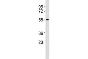 Western blot testing of CB1 antibody at 1:2000 dilution + A431 lysate (CNR1 antibody  (AA 433-468))