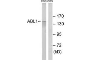 Western blot analysis of extracts from COS7 cells, treated with calyculinA 50ng/ml 30', using ABL1 (Ab-735) Antibody.