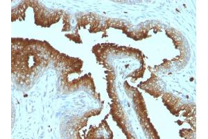 Immunohistochemistry (IHC) image for anti-CD63 (CD63) antibody (ABIN6941230)
