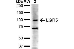 Western blot analysis of Human Cervical cancer cell line (HeLa) lysate showing detection of ~100 kDa LGR5 protein using Rabbit Anti-LGR5 Polyclonal Antibody (ABIN5667925). (LGR5 antibody  (AA 500-600) (Atto 594))