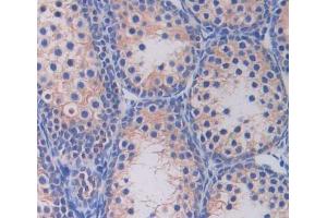 #VALUE! (CHRNE antibody  (AA 21-239))