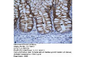Human Intestine (SUV39H1 antibody  (C-Term))
