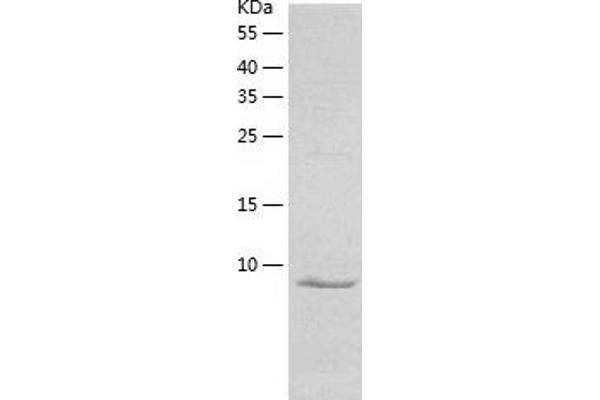 Galanin Protein (GAL) (AA 20-123) (His tag)
