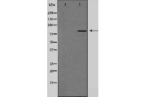 Western blot analysis of extracts from HeLa cells, using PMS2 antibody.