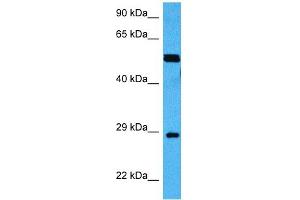 Host:  Mouse  Target Name:  MECP2  Sample Tissue:  Mouse Skeletal Muscle  Antibody Dilution:  1ug/ml
