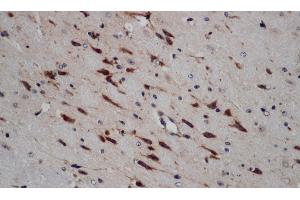 Immunohistochemistry of paraffin-embedded Mouse brain using ERG Polyclonal Antibody at dilution of 1:50 (ERG antibody)