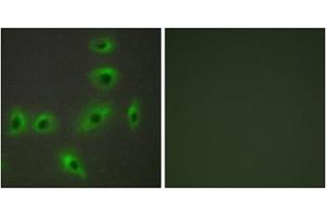 Immunofluorescence analysis of HUVEC cells, using BAX antibody. (BAX antibody  (Internal Region))