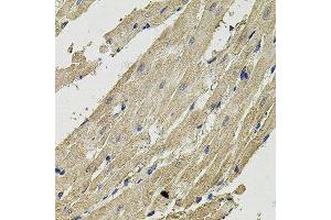 Immunohistochemistry of paraffin-embedded rat heart using SMN2 antibody. (SMN2 antibody  (AA 1-197))