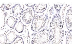 Immunohistochemistry (IHC) image for anti-Nuclear Receptor Subfamily 1, Group H, Member 4 (NR1H4) (AA 375-568) antibody (ABIN7440740)