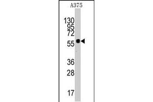 Western blot analysis of KREMEN1 polyclonal antibody  in A-375 cell line lysates (35 ug/lane). (KREMEN1 antibody  (N-Term))