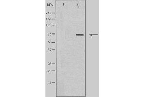 Western blot analysis of extracts from 293 cells, using SLC5A2 antibody. (SLC5A2 antibody  (N-Term))