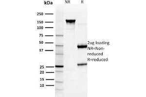 SDS-PAGE Analysis Purified GST Mu3 Mouse Monoclonal Antibody (CPTC- GSTMu3-1). (GSTM3 antibody)