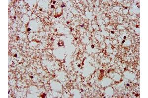 IHC image of ABIN7154521 diluted at 1:400 and staining in paraffin-embedded human brain tissue performed on a Leica BondTM system. (GHITM antibody  (AA 293-345))