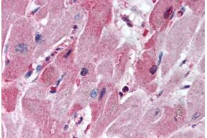 Human Heart (formalin-fixed, paraffin-embedded) stained with HTR3A antibody ABIN297638 at 5 ug/ml followed by biotinylated goat anti-rabbit IgG secondary antibody ABIN481713, alkaline phosphatase-streptavidin and chromogen. (Serotonin Receptor 3A antibody  (AA 21-36))