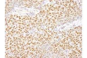 Immunohistochemistry (IHC) image for anti-Heterogeneous Nuclear Ribonucleoprotein U-Like 1 (HNRNPUL1) (AA 50-100) antibody (ABIN7448953)