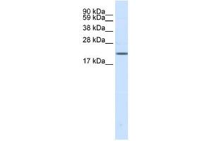 Western Blot showing SCN3B antibody used at a concentration of 1-2 ug/ml to detect its target protein. (SCN3B antibody  (N-Term))
