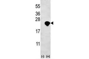 Western blot analysis of Bid antibody and 293 cell lysate (2 ug/lane) either nontransfected (Lane 1) or transiently transfected (2) with the Bid gene. (BID antibody  (AA 68-103))