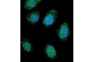 Confocal immunofluorescent analysis of DTNA / DRP3 Antibody (C-term) Cat. (DTNA antibody  (C-Term))