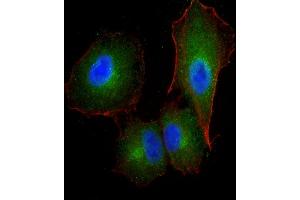 Immunofluorescent analysis of 4 % paraformaldehyde-fixed, 0. (F13A1 antibody  (AA 170-204))