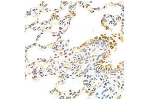 Immunohistochemistry (Paraffin-embedded Sections) (IHC (p)) image for anti-Eukaryotic Translation Initiation Factor 2-alpha Kinase 1 (EIF2AK1) antibody (ABIN7073875)