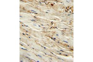 immunohistochemistry analysis in formalin fixed and paraffin embedded mouse heart tissue followed by peroxidase conjugation of the secondary antibody and DAB staining. (Endoglin antibody  (AA 380-409))