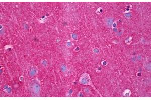 Anti-NDRG4 antibody IHC staining of human brain, cortex neuropil. (NDRG4 antibody  (AA 1-340))