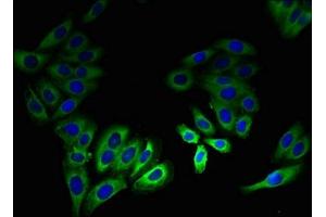 Immunofluorescent analysis of HepG2 cells using ABIN7158219 at dilution of 1:100 and Alexa Fluor 488-congugated AffiniPure Goat Anti-Rabbit IgG(H+L) (LSMEM2 antibody  (AA 1-96))