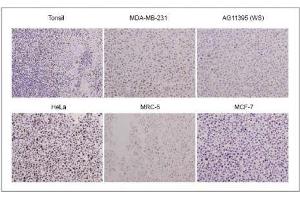 WRN antibody (mAb) tested by Immunohistochemistry. (RECQL2 antibody)