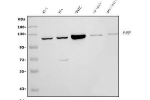 Western blot analysis of PARP using anti-PARP antibody (ABIN7602277).