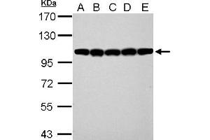 WB Image CSE1L antibody detects CSE1L protein by western blot analysis. (Exportin 2 antibody  (Center))